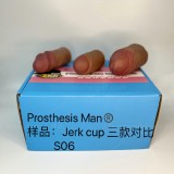 Prosthesis_Man_Jerk_cup_comparison_02