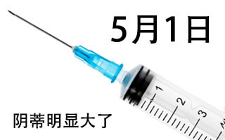 2014-05-01-injection.jpg